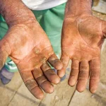5 Cara Menghindari Tangan Kasar Akibat Pekerjaan Berat