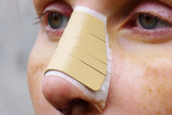 10 Cara Merawat Hidung Setelah Operasi atau Cedera 10 Cara Merawat Hidung Setelah Operasi atau Cedera