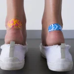 5 Cara Menghindari Lecet di Kaki Saat Pakai Sepatu Baru