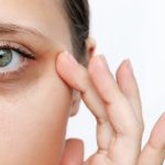 5 Tips Mengatasi Kantung Mata dan Lingkaran Hitam