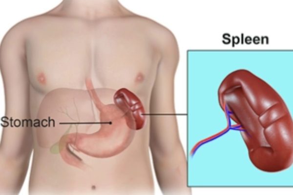 5 Langkah Merawat Limpa setelah Trauma atau Benturan
